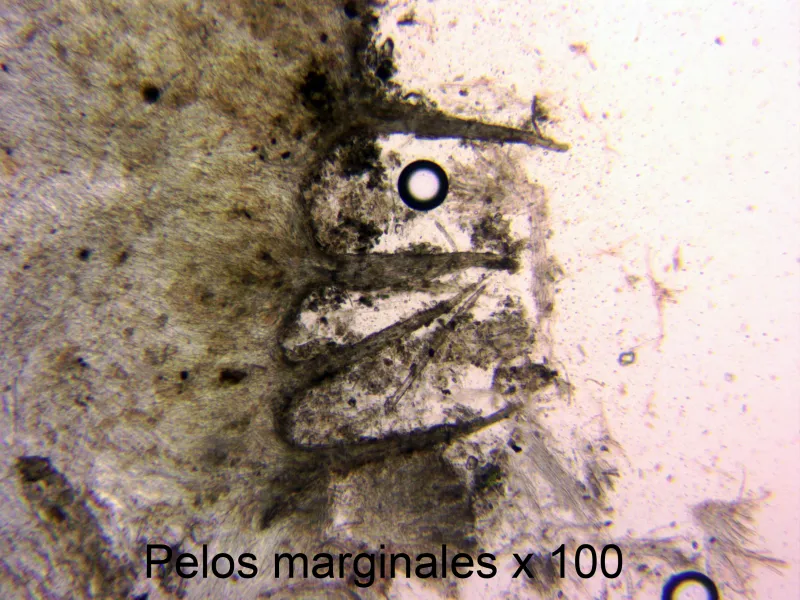 Cyathicula coronata 13 - Pelos marginales x 100